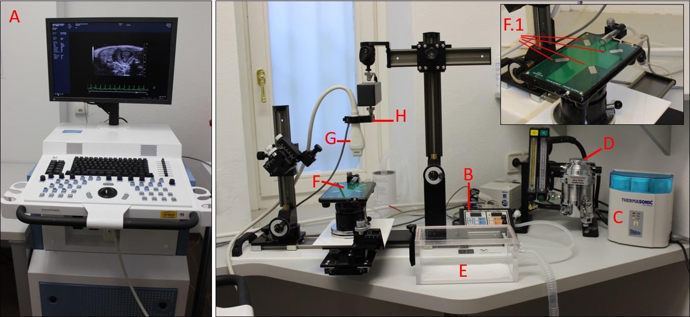Hochfrequenz-Ultraschallger&auml;t